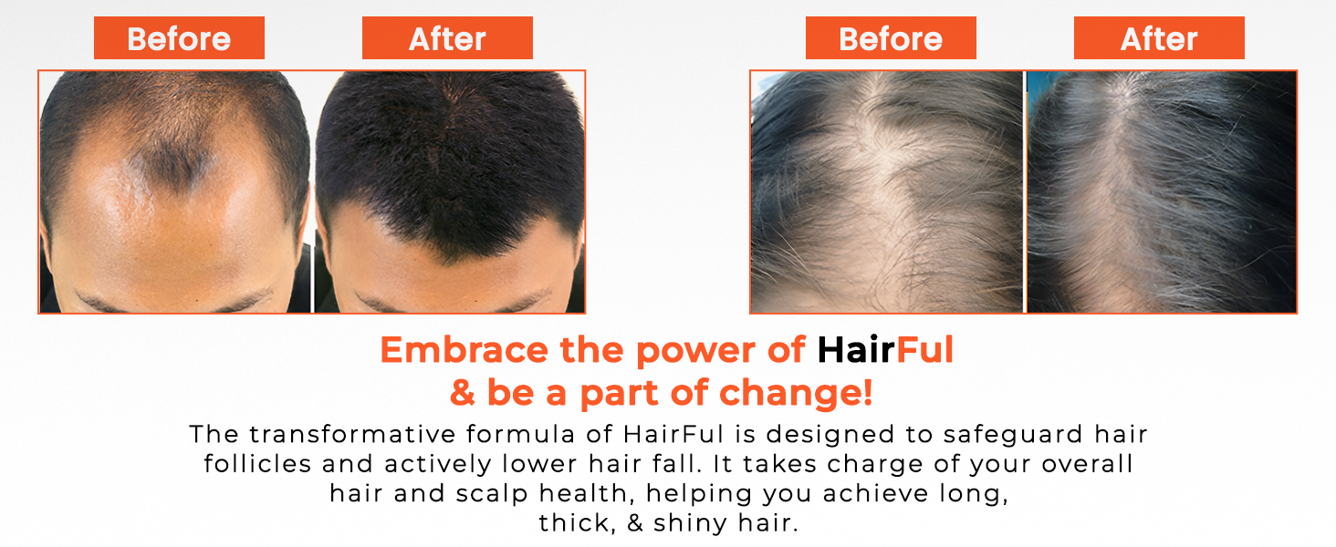 HairFul Biotin Tablets-Collagen Peptides, Green Tea Extract and Grape Seed Extract Tablets - Vitamins and Minerals