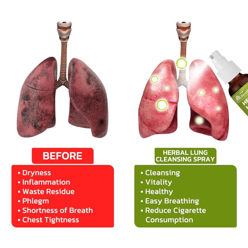 herbal-lung-cleansing-spray-respinature--6.jpg