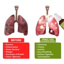 herbal-lung-cleansing-spray-respinature--6.jpg
