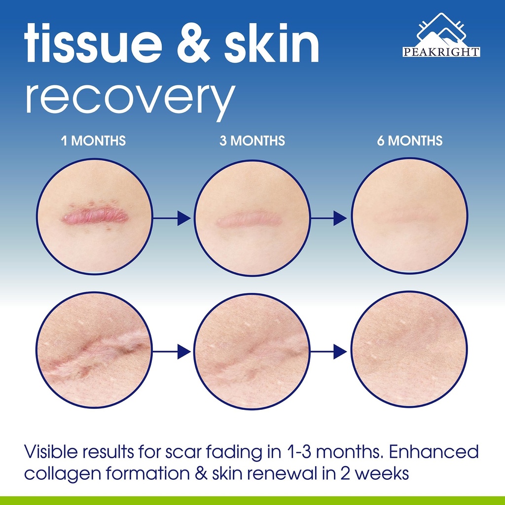 wound-healing-supplement-collagen-comple-6.jpg