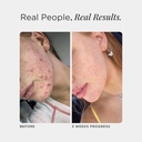 jshealth-skin-and-digestion-formula-clea-5.jpg