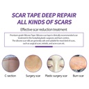 hpufkot-medical-grade-silicone-scar-shee-6.jpg