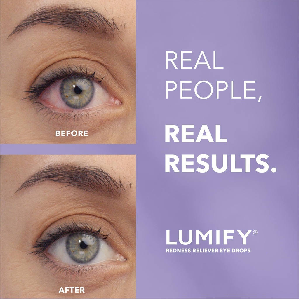 lumify-eye-drops-for-red-eyes-redness-re-2.jpg