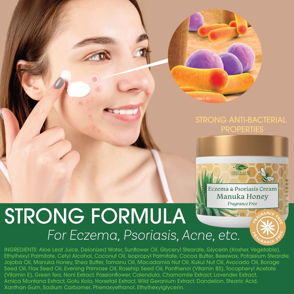 green-leaf-naturals-manuka-honey-eczema--3.jpg