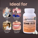 bone-tite-osseointegration-support-suppl-5.jpg