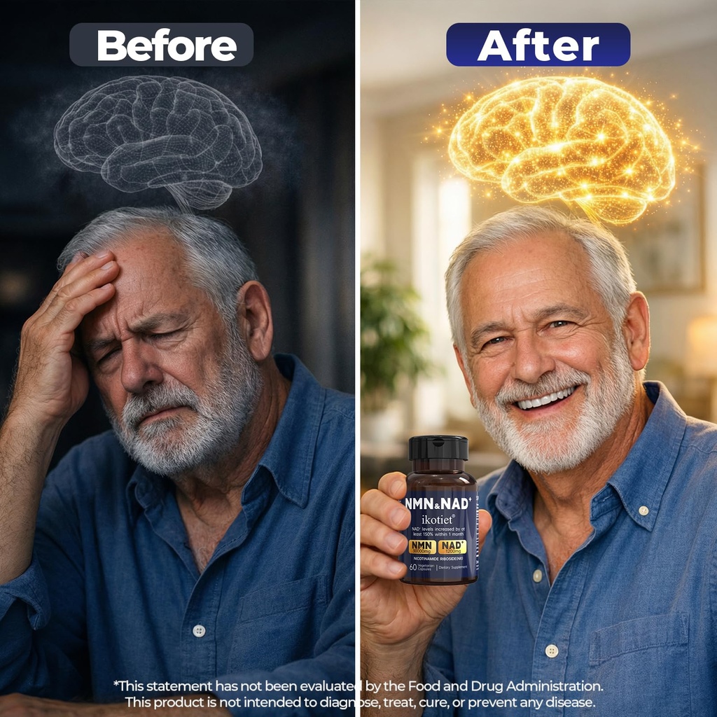 nmn-supplement-with-nad-and-nicotinamide-81lqUr59hDL.jpg