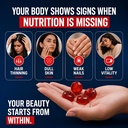 nutrabud-biotin-hair-gummies-for-women-m-81cpsflW+YL.jpg