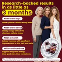 liposomal-nmn-supplement-1800mg-per-serv-819pqnE+7kL.jpg
