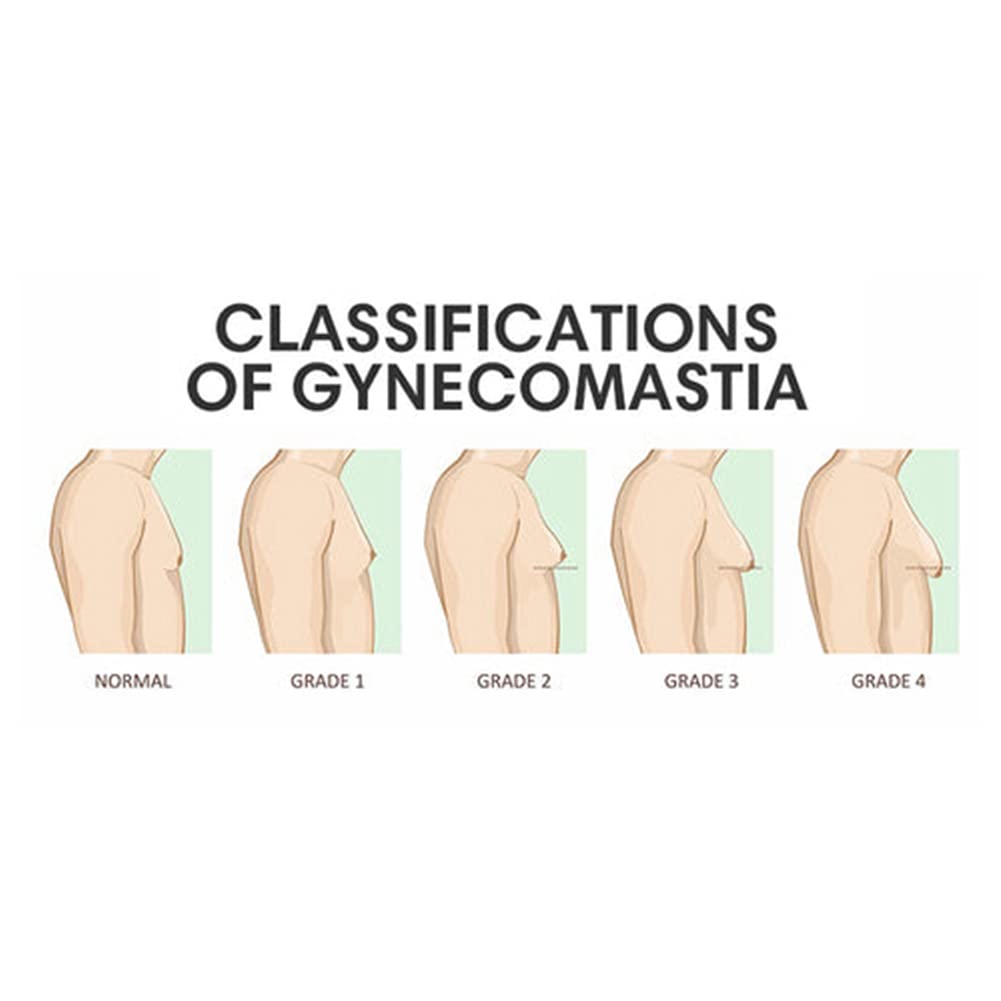 ikasus-powerful-gynecomastia-tightening--3.jpg