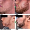 unscented-beard-oil---natural-non-gmo-fa-4.jpg