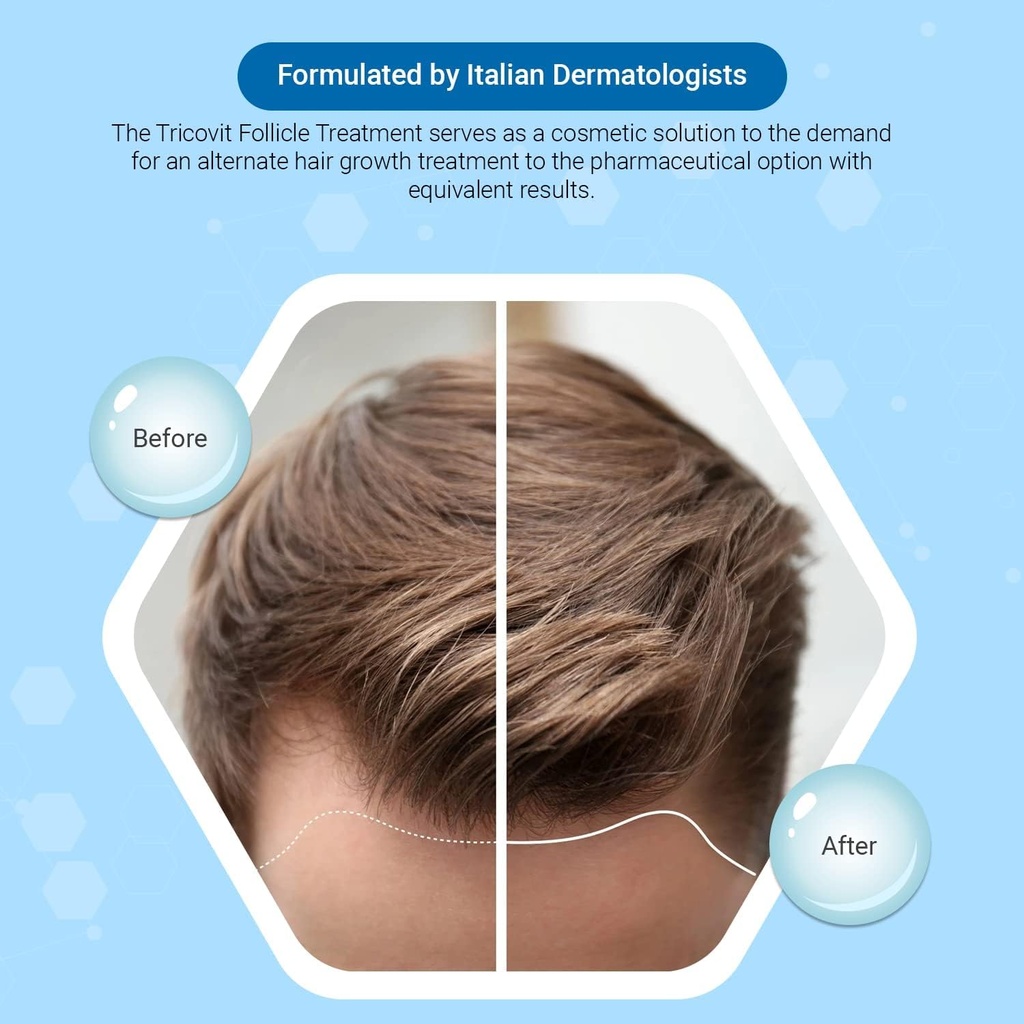tricovit-hair-growth-supplement---nail-h-2.jpg