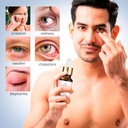 roycederm-stye-eye-treatment-serum-natur-5.jpg