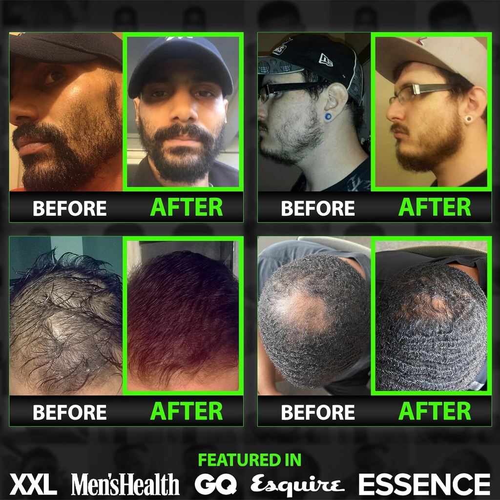 beard-growth-kit-w-2x-biotin-beard-balm--5.jpg