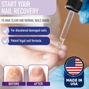 zanaquick-extra-strength-toenail-fingern-2.jpg