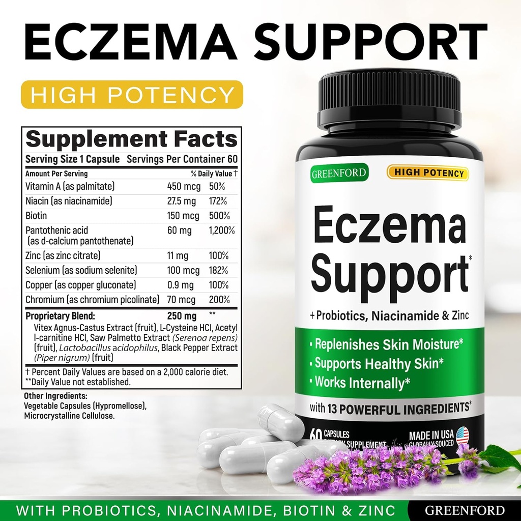 greenford-eczema-treatment-support-for-n-2.jpg