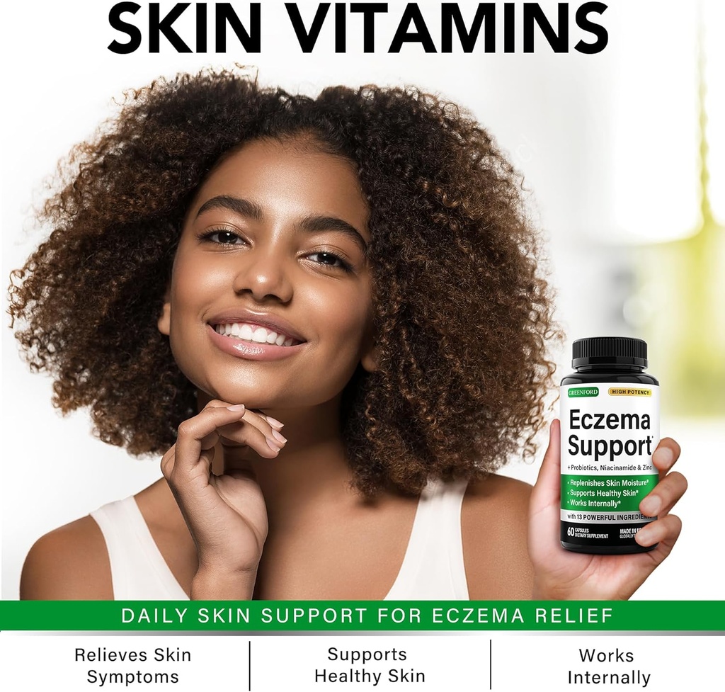 greenford-eczema-treatment-support-for-n-3.jpg