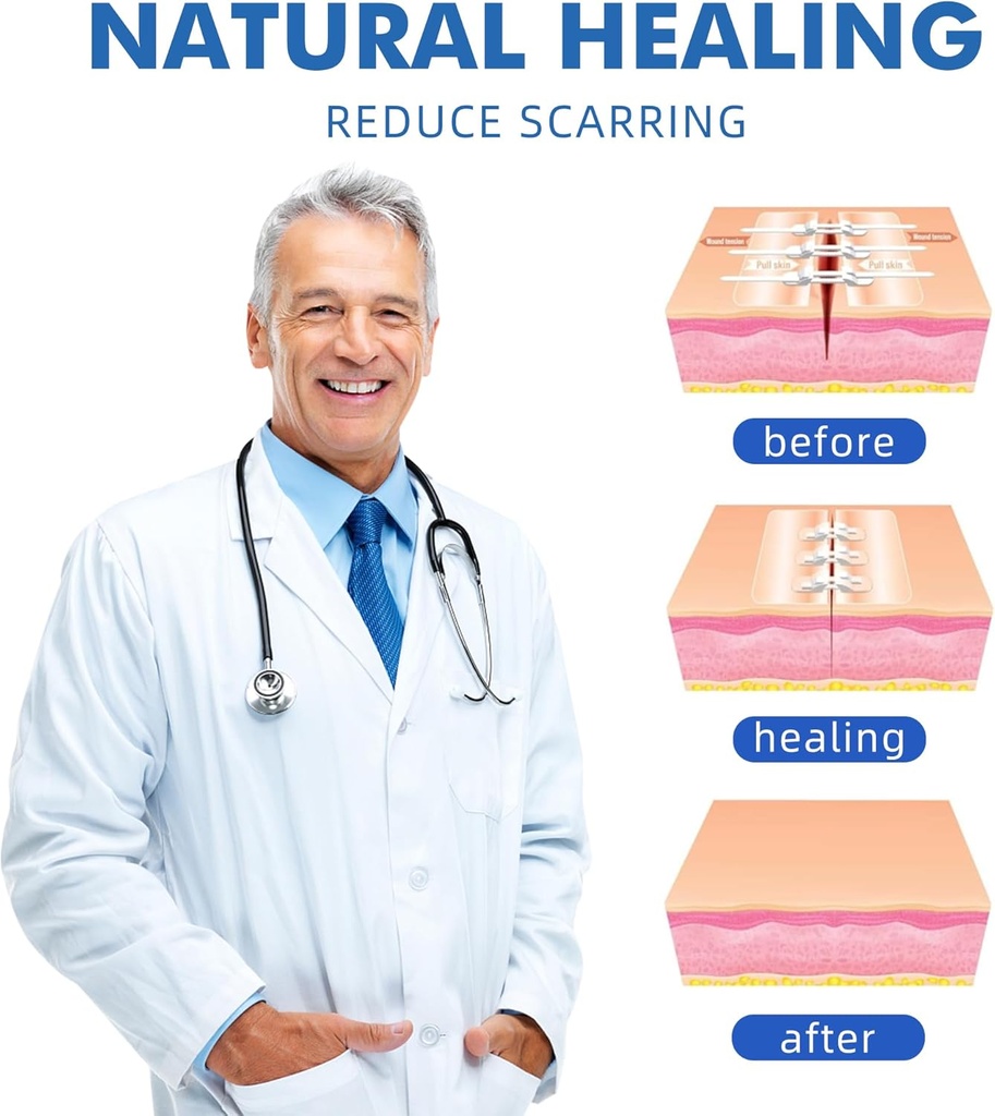 2-pcs-emergency-laceration-closuresbutte-4.jpg