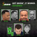 beard-growth-kit-wgrow-xxl-beard-oilseru-4.jpg