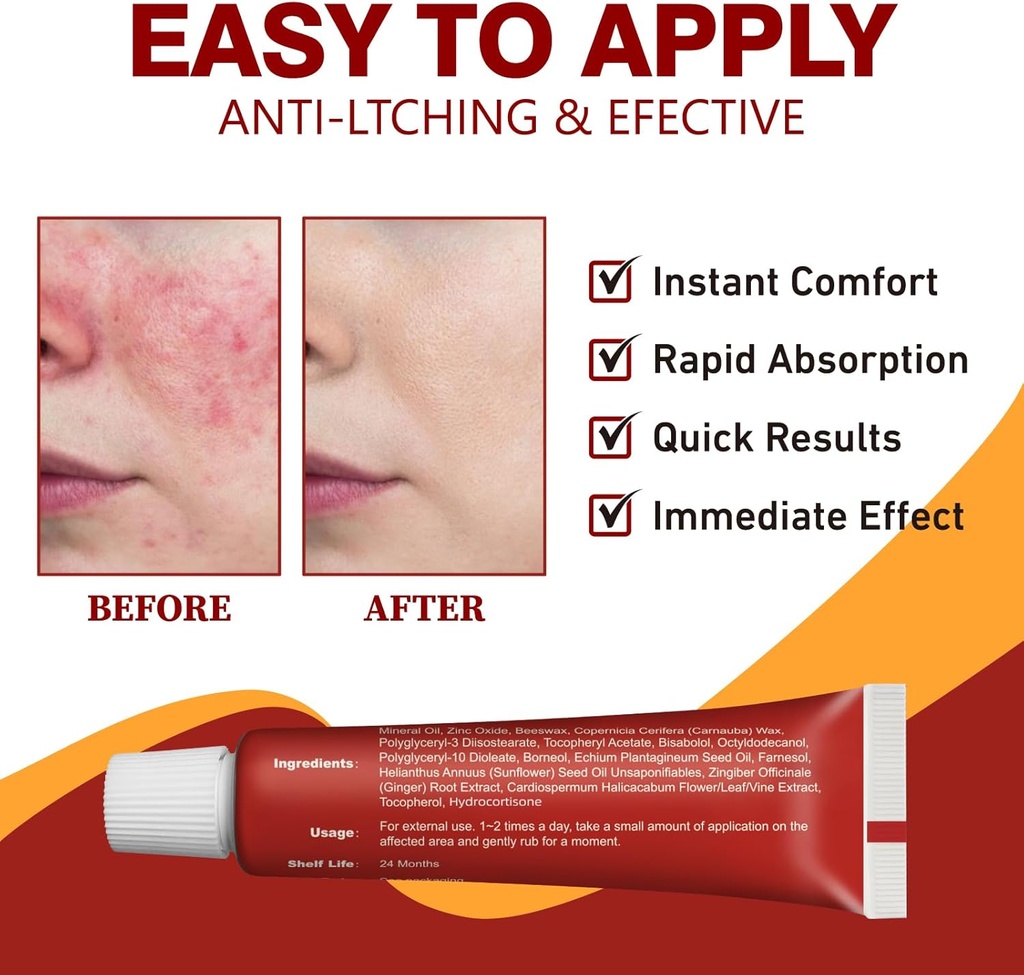 hydrocortisone-cream---otc-anti-itch-rel-3.jpg