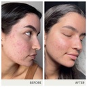 jane-iredale-skin-accumax-nutritional-su-4.jpg