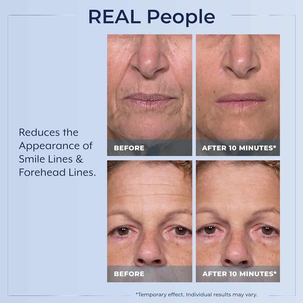 plexaderm-rapid-reduction-eye-serum---vi-4.jpg
