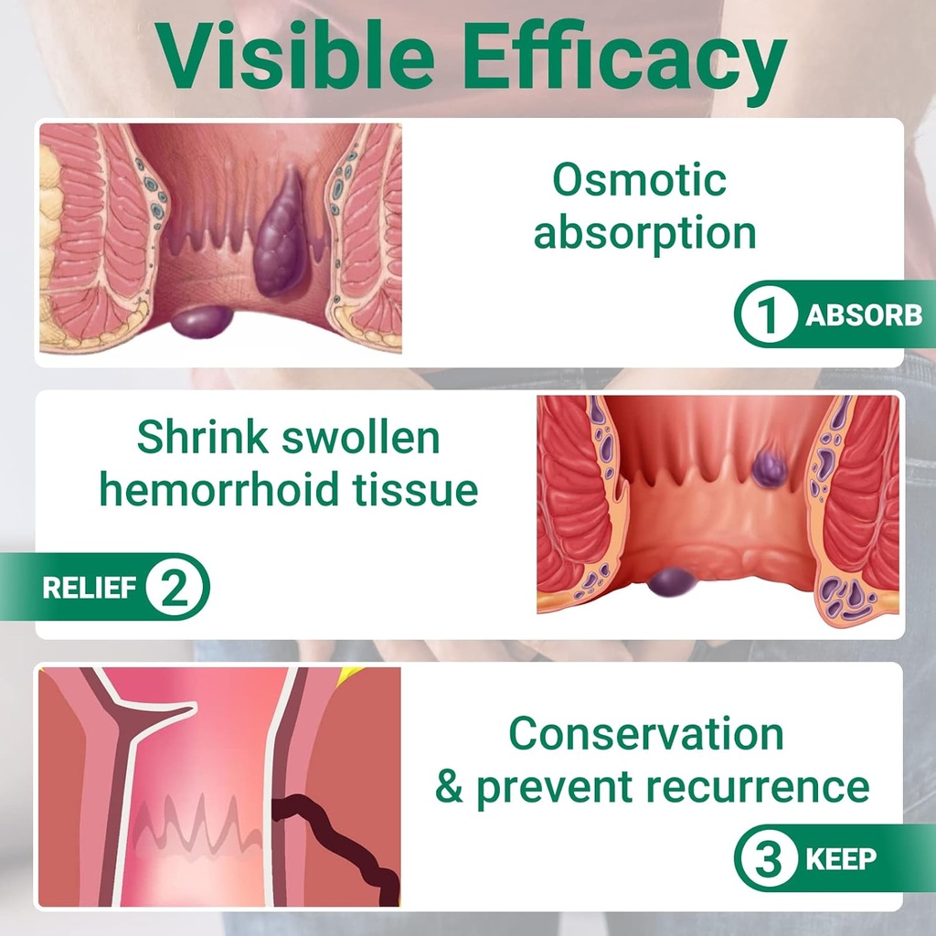 hemorrhoid-treatment-ointment-maximum-st-6.jpg