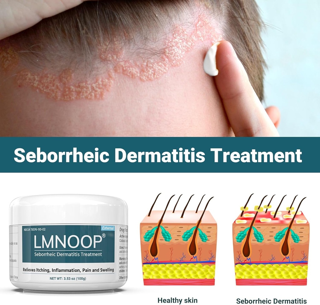 seborrheic-dermatitis-cream-extra-streng-2.jpg