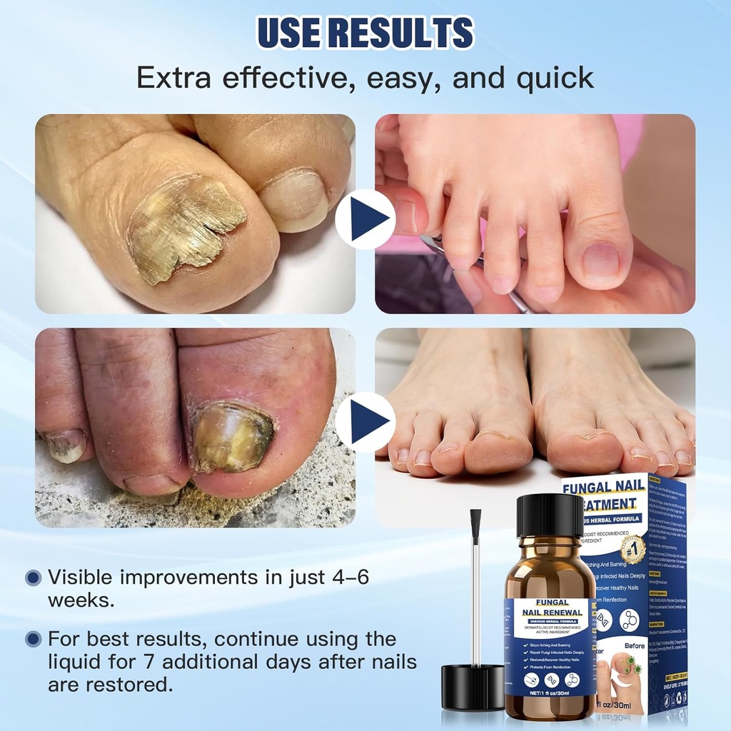 toenail-fungus-treatmentfoot-fungus-trea-6.jpg