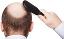 hair-growth-support-vitamins---dht-block-2.jpg