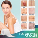 boysea-silicone-scar-sheets-16-x-120-cle-6.jpg