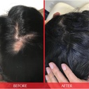 hairtamin-vegan-hair-vitamins-for-faster-5.jpg