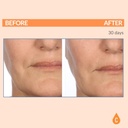 serious-skincare---vitamin-c-ester-pads--3.jpg