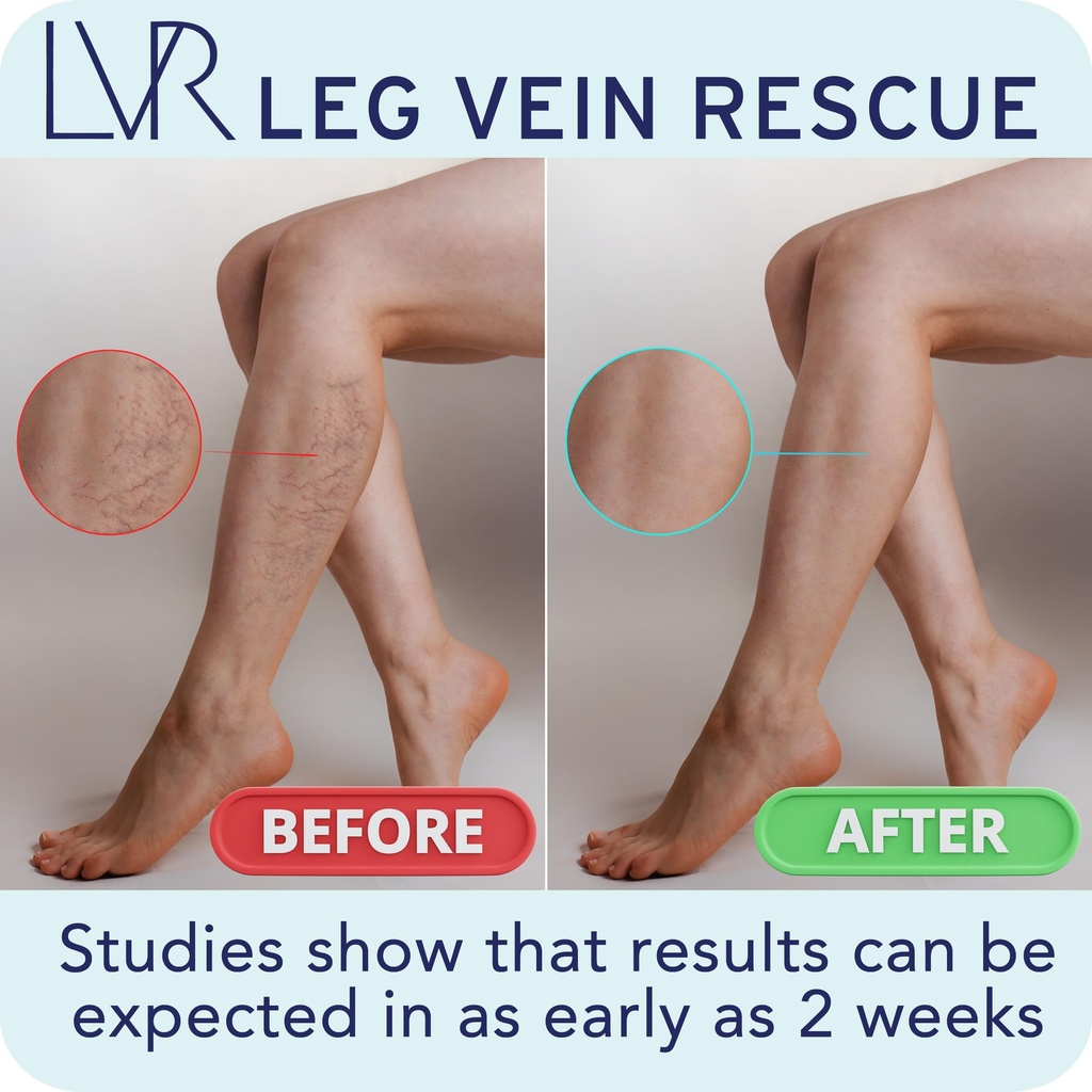 diosmin-leg-circulation-supplement-clini-6.jpg