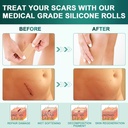 silicone-scar-sheets-silicone-scar-tape--2.jpg