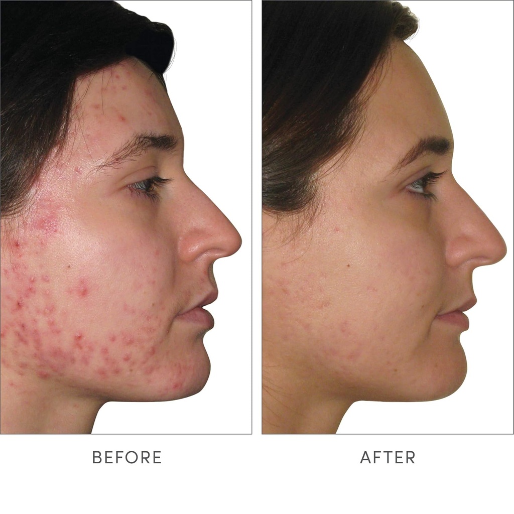 jane-iredale-skin-accumax-nutritional-su-4.jpg
