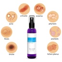 topical-probiotic-spray-for-skin-13-stra-2.jpg