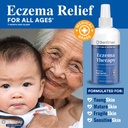 skinsmart-antimicrobial-eczema-therapy-w-5.jpg