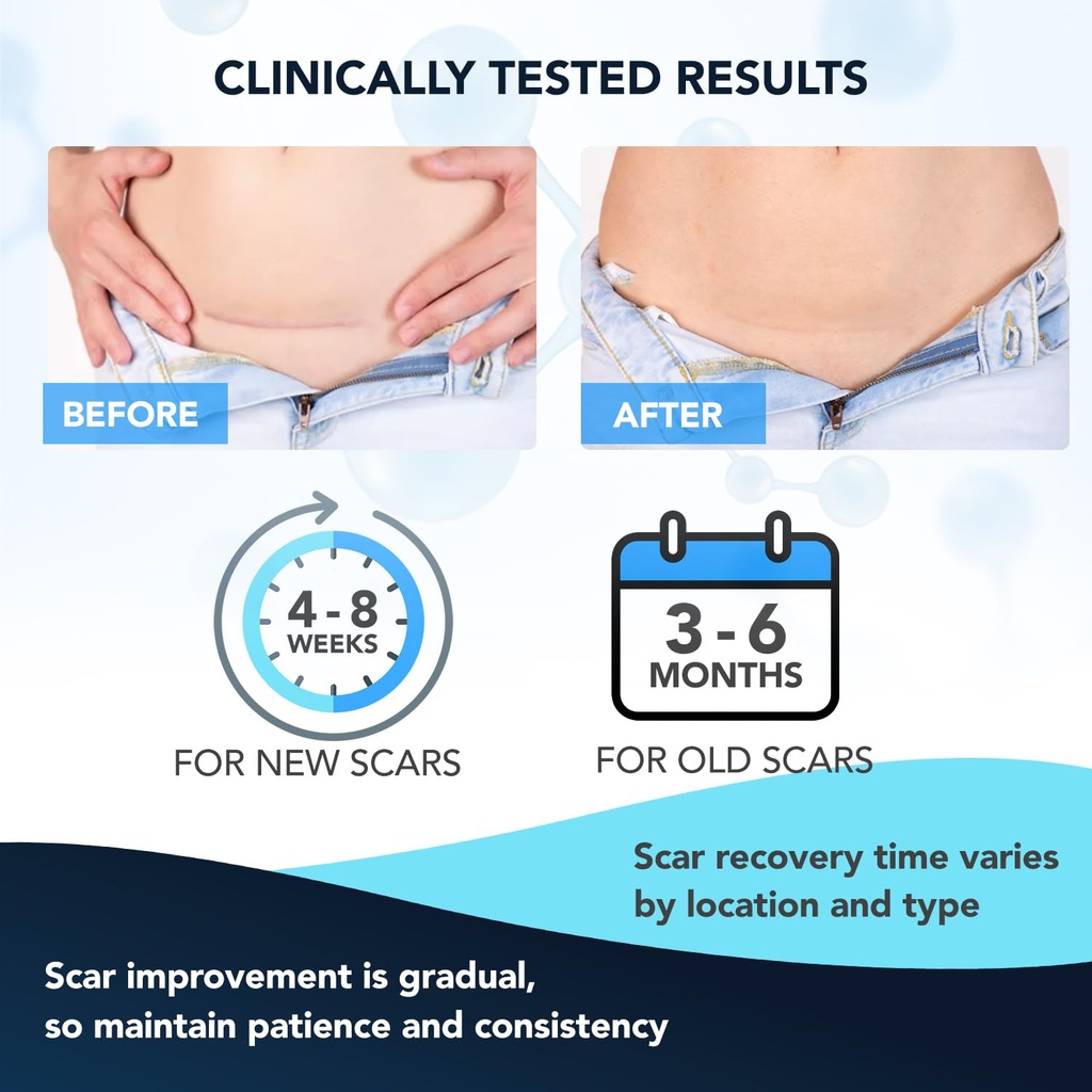 silicone-scar-gel-silicone-gel-for-scars-3.jpg