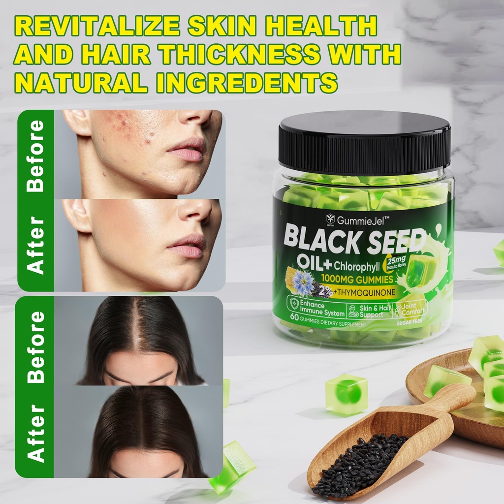 black-seed-oil-gummies-chlorophyll-bioti-6.jpg