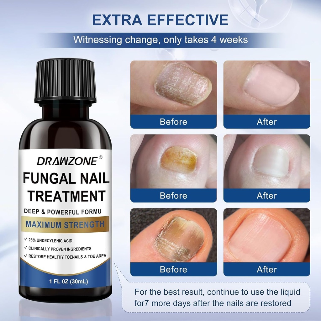 toenail-fungus-treatment-extra-strength--4.jpg