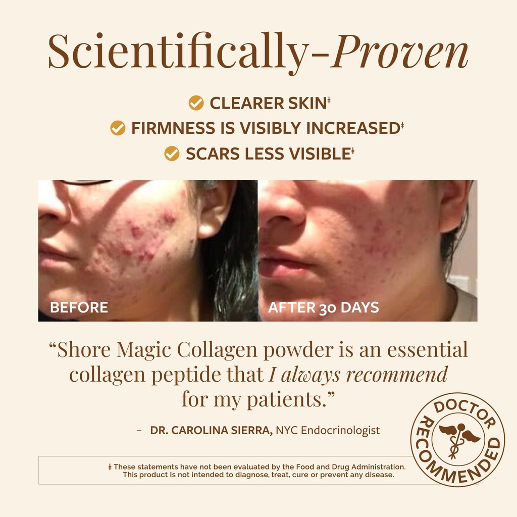 shore-magic-premium-marine-collagen-powd-4.jpg