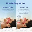 difiney-advanced-anti-snoring-device-4-0-3.jpg