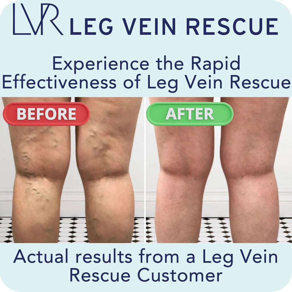 diosmin-leg-circulation-supplement-clini-3.jpg