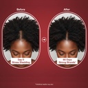 growth-gummies-for-black-women-hair-grow-2.jpg