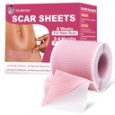 Silicone Scar Sheets, Silicone Scar Tape voor chirurgische littekens,C-sectie,Tummy Tuck, Keloid Bump Removal, Face Tape voor rimpels Overnachting (1.6"X 59" Roll-1.5M-Pigment Reduction-Pink)