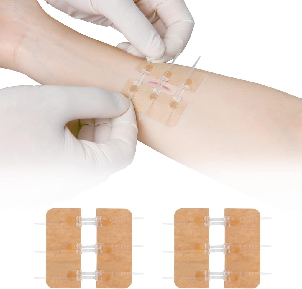 Zip Stitch Laceration Repareren zonder steken Vlinder Bandaids Quick Clot - Noodgewonde sluitingen Apparaat 2 Pieces(PU)