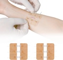 Zip Stitch Laceration Repareren zonder steken Vlinder Bandaids Quick Clot - Noodgewonde sluitingen Apparaat 2 Pieces(PU)