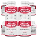 Acne pillen supplement- Heldere huid vitamines pil voor olieachtige huidbehandeling, Hormonale vlekken, Antivlekken & Cystische Acnes Supplementen voor vrouwen, mannen, tieners & volwassenen- 240 orale tabletten